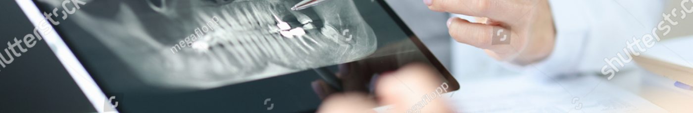 stock-photo-dentist-shows-an-x-ray-of-jaw-to-patient-on-tablet-dentist-services-concept-1865702200